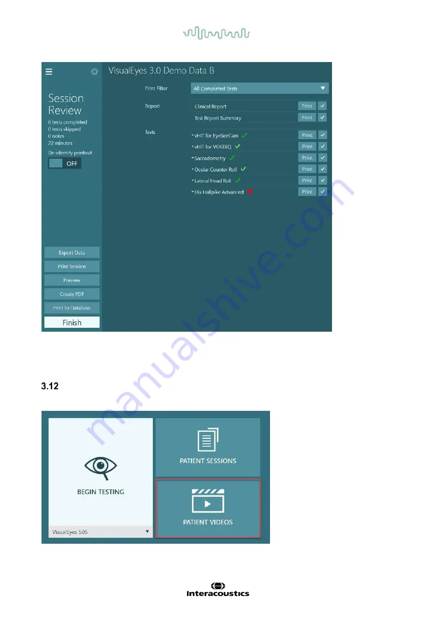 Interacoustics VisualEyes 505 Скачать руководство пользователя страница 100