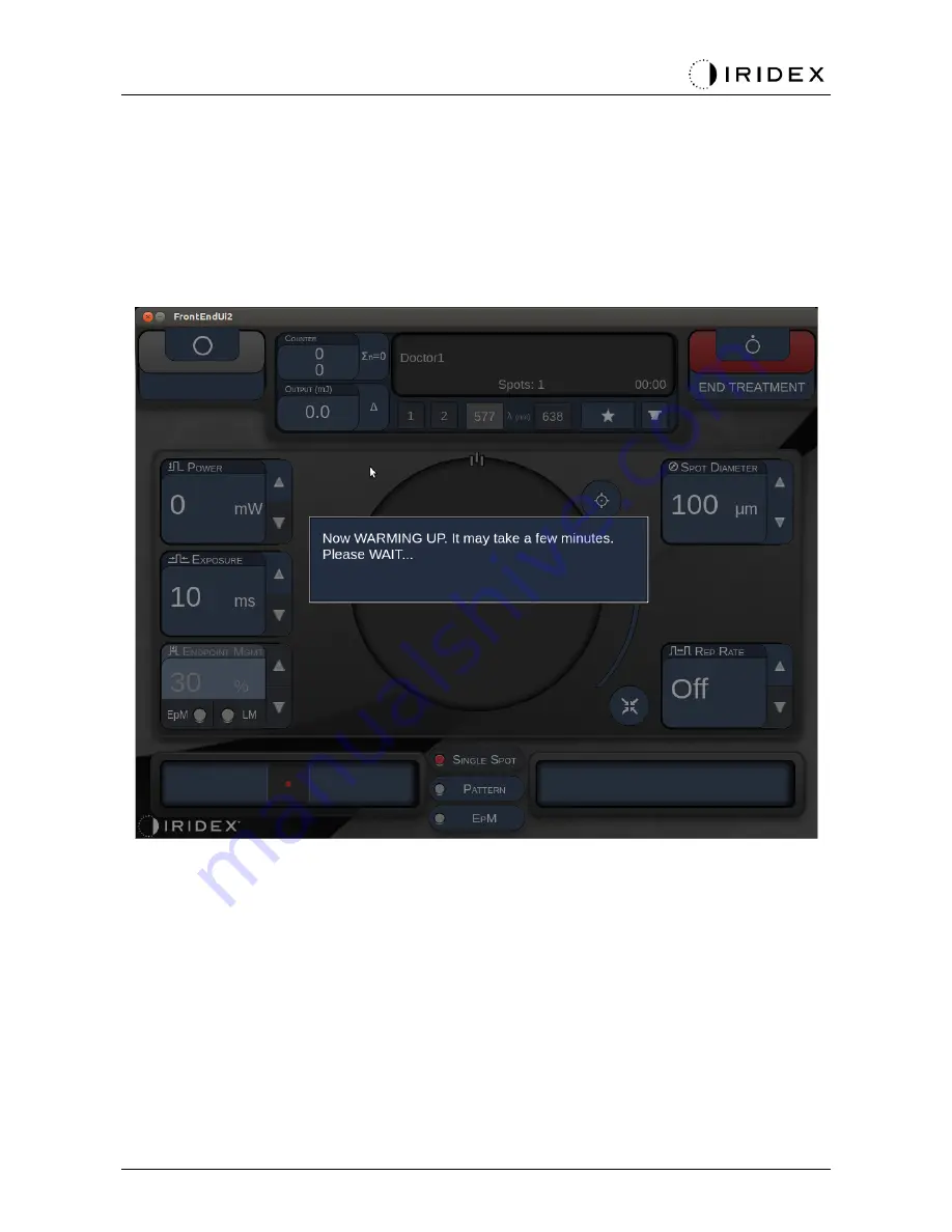 Iridex PASCAL Synthesis Скачать руководство пользователя страница 41