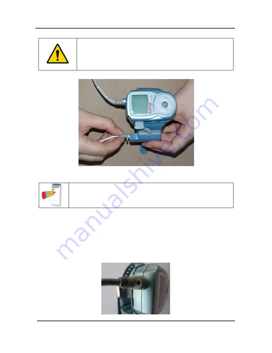 Itamar Medical WatchPAT 200 Unified Operation Manual Download Page 41