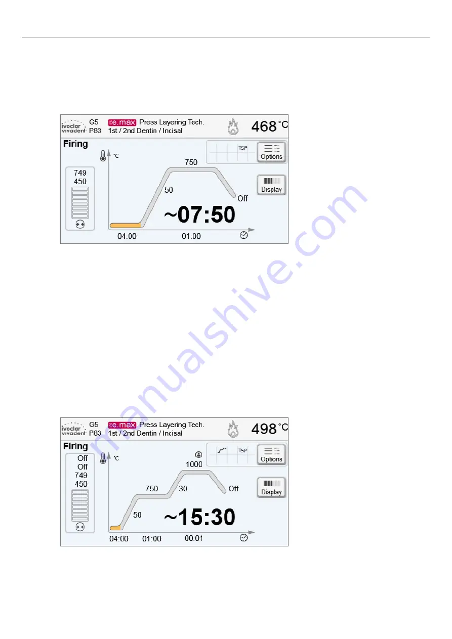 Ivoclar Vivadent Programat EP3010 Operating Instructions Manual Download Page 35