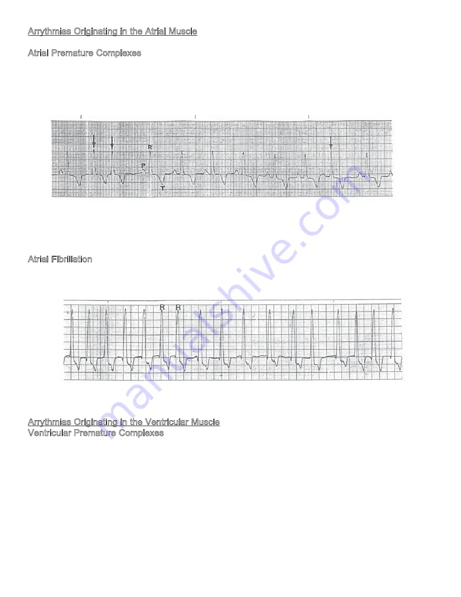 JORGENSEN J1010 Manual Download Page 27