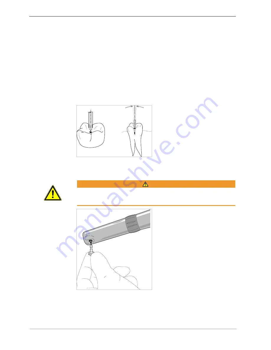 KaVo DIAGNOdent 2190 Instructions For Use Manual Download Page 20