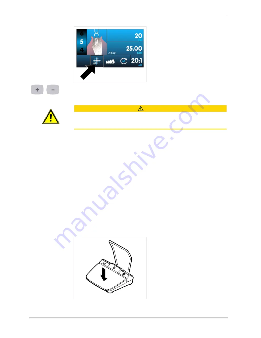 KaVo EXPERTsurg LUX 1.008.3500 Instructions For Use Manual Download Page 49