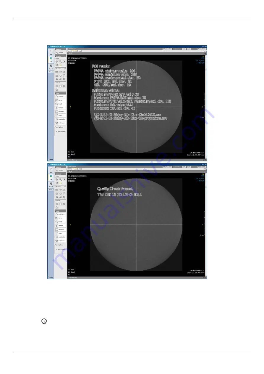 KaVo OP 3D Pro User Manual Download Page 89