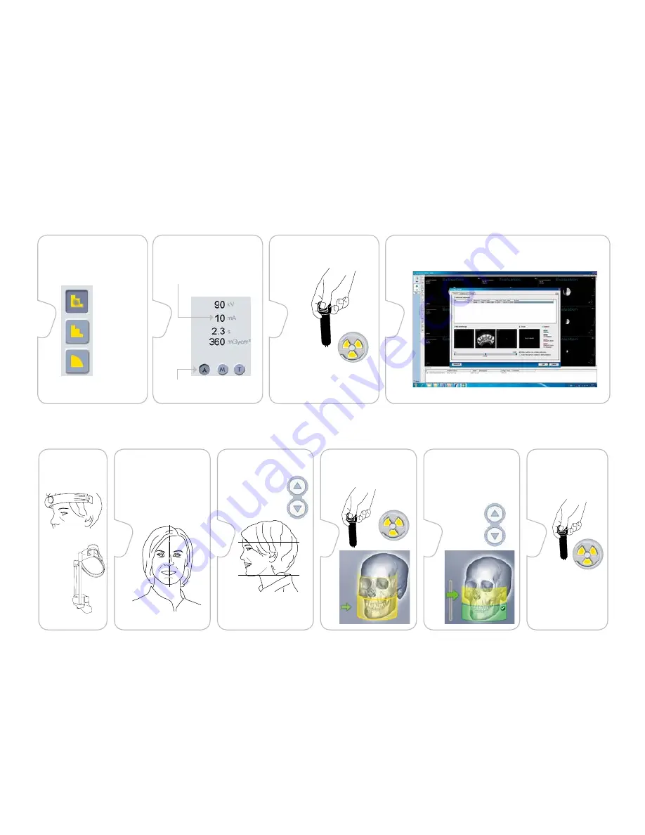 KaVo ORTHOPANTOMOGRAPH OP300 Maxio Quick Manual Download Page 3