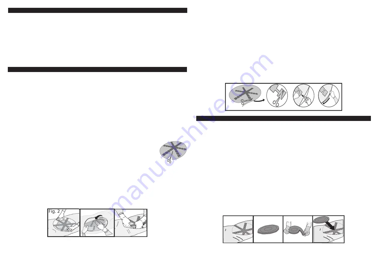 KCI ABThera Instructions For Use Manual Download Page 70