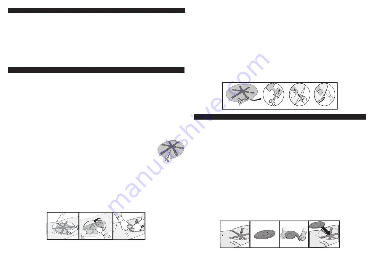 KCI ABThera Instructions For Use Manual Download Page 79