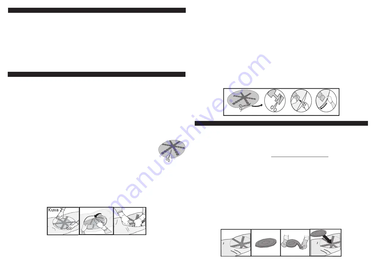 KCI ABThera Instructions For Use Manual Download Page 106