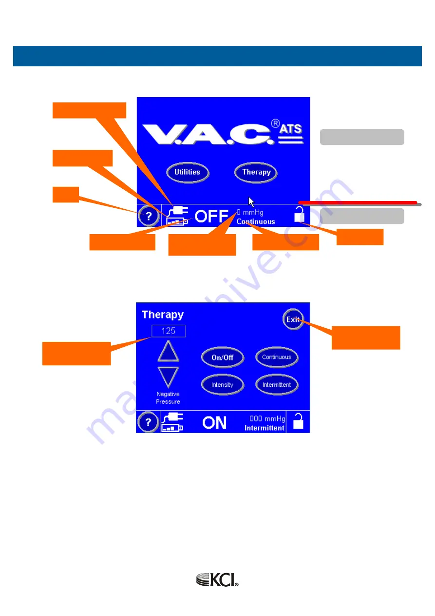 KCI V.A.C. ATS Operation And Maintenance Manual Download Page 9