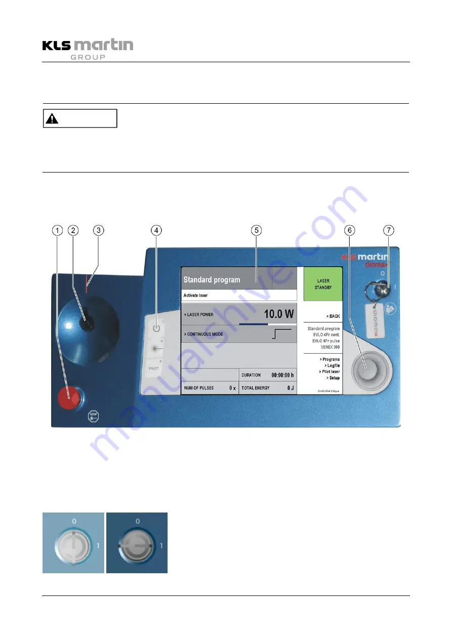 KLS Martin diomax Instructions For Use Manual Download Page 30