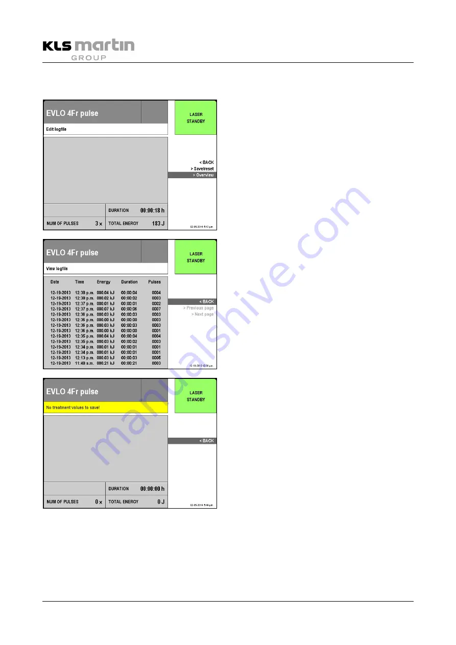 KLS Martin diomax Instructions For Use Manual Download Page 56