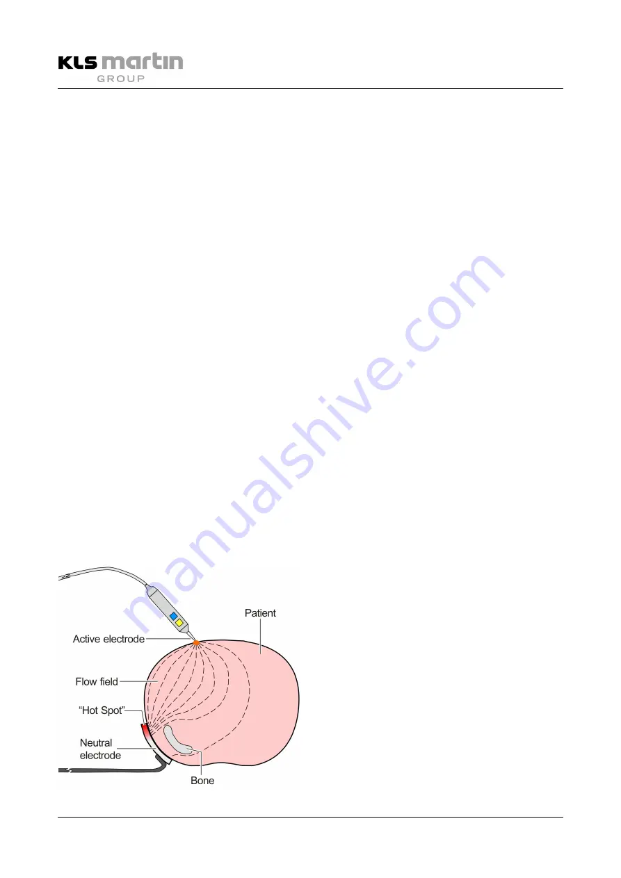 KLS Martin maXium smart C Instructions For Use Manual Download Page 20