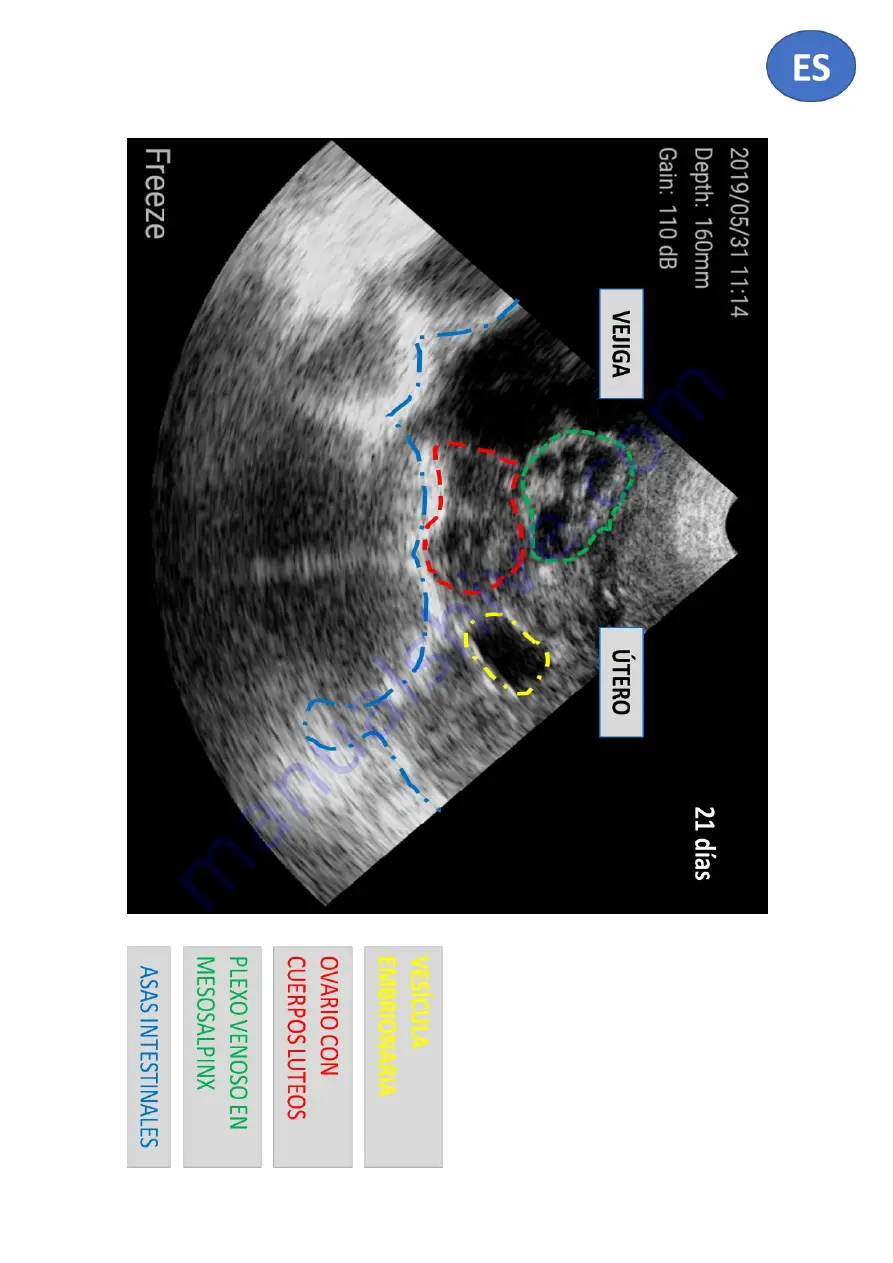 Kubus W3 Scan Manual Download Page 7