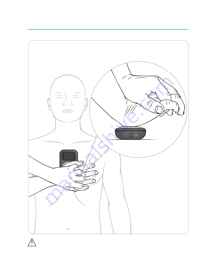 laerdal CPRmeter 2 User Manual Download Page 85