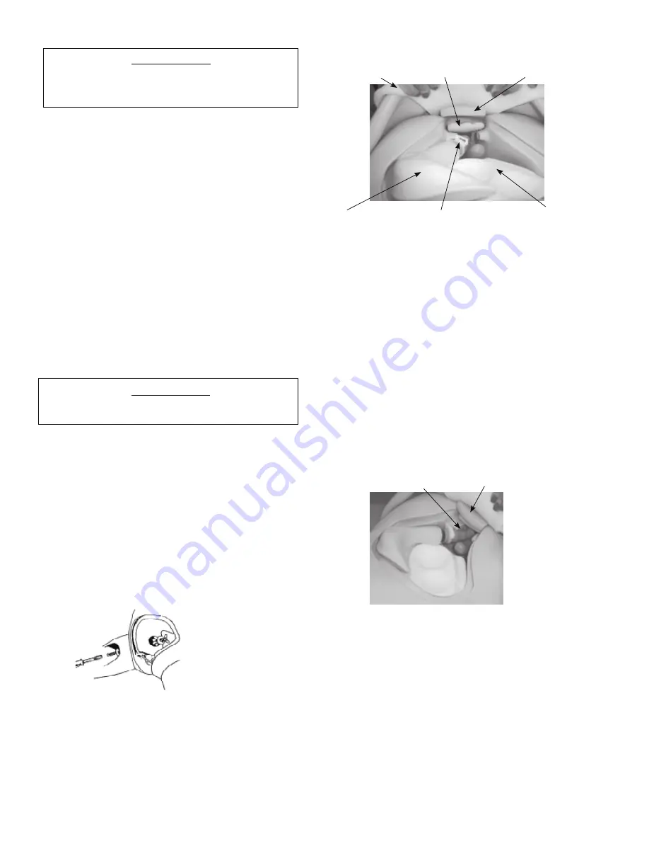 laerdal Nursing Anne VitalSim Directions For Use Manual Download Page 80