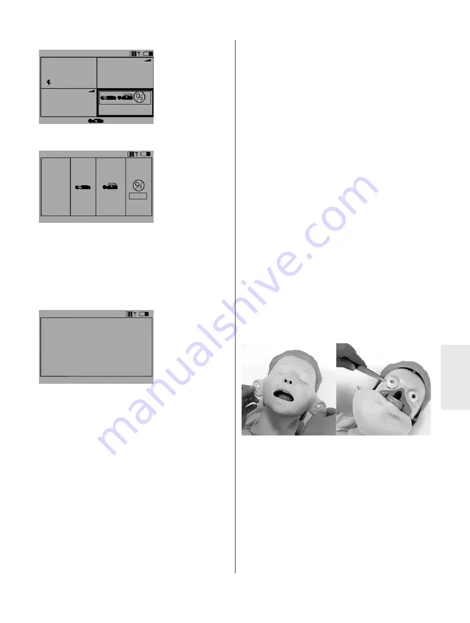 laerdal Resusci Anne Simulator Directions For Use Manual Download Page 61