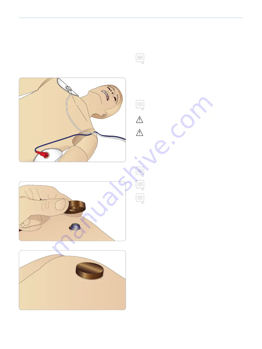 laerdal SimMan 3G Trauma Скачать руководство пользователя страница 38