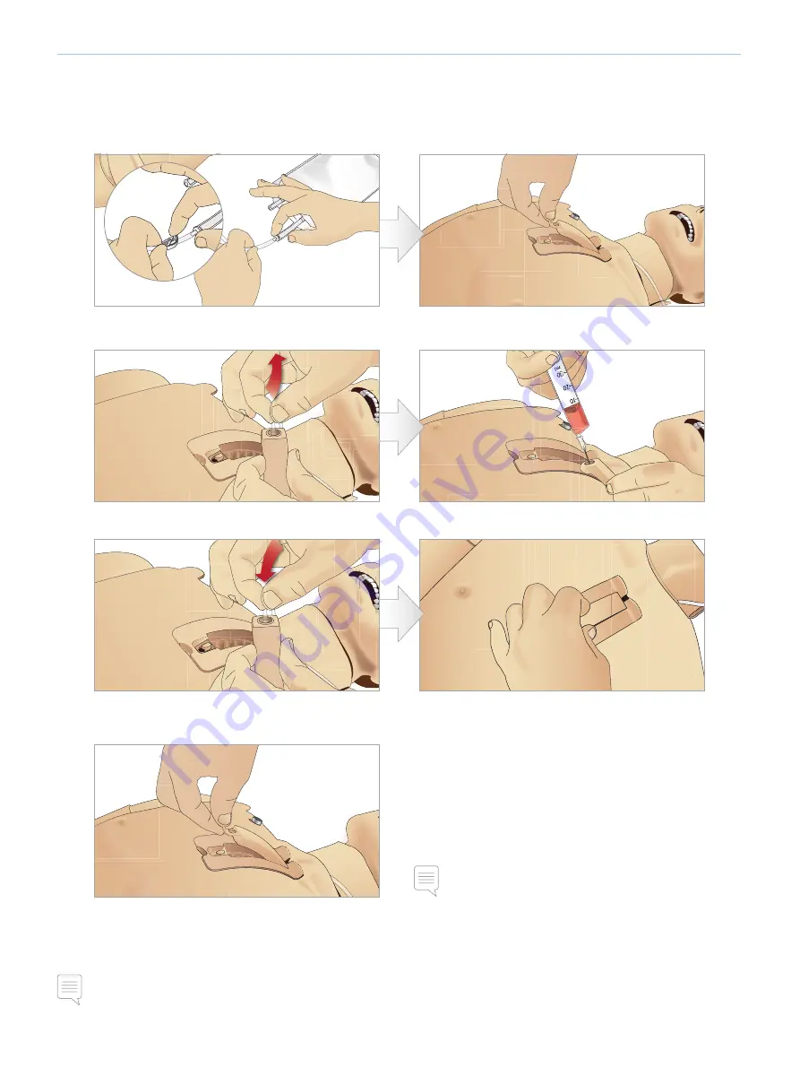 laerdal SimMan 3G Trauma Directions For Use Manual Download Page 40