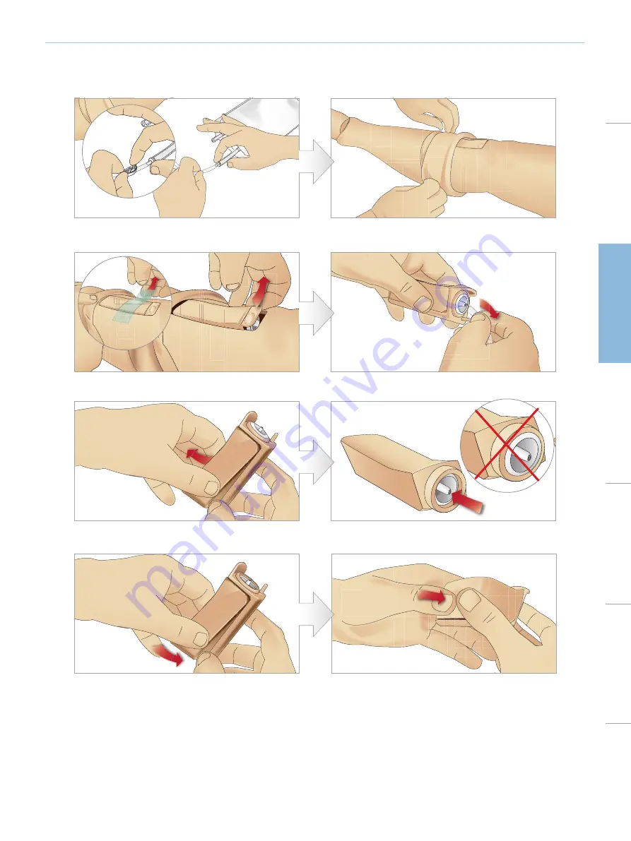 laerdal SimMan 3G Trauma Directions For Use Manual Download Page 41