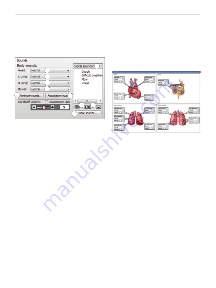 laerdal SimMan 3G Trauma Directions For Use Manual Download Page 48