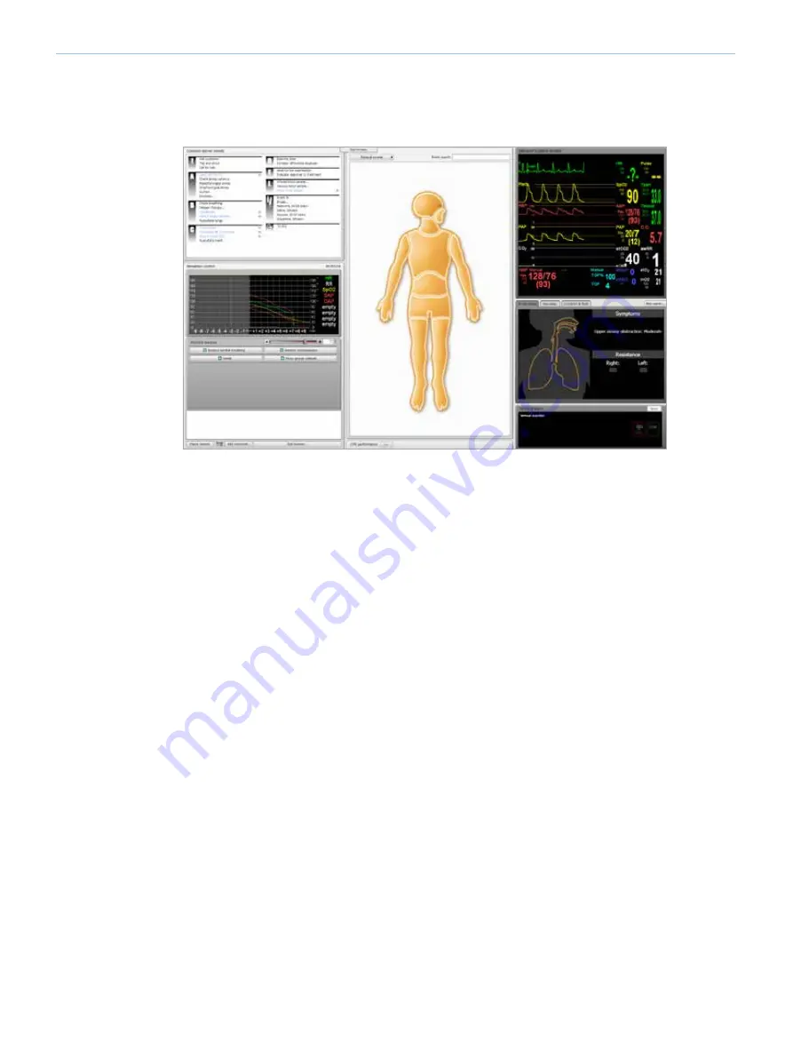 laerdal SimMan Essential Directions For Use Manual Download Page 28