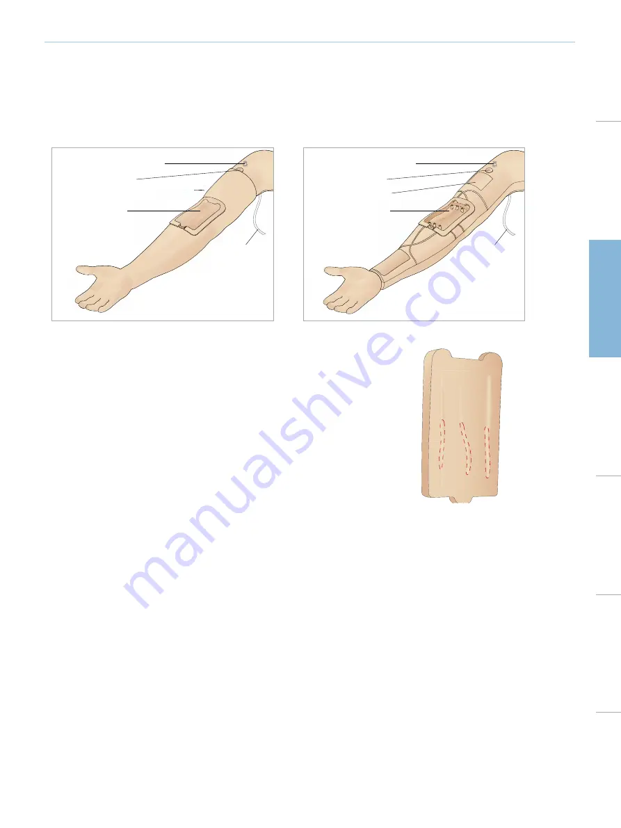 laerdal SimMan Essential Directions For Use Manual Download Page 39