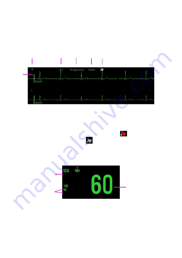 Lepu Medical AIView 12V Operator'S Manual Download Page 87