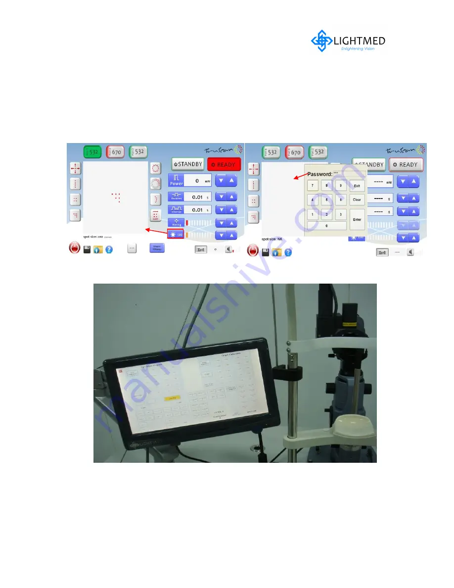 Lightmed TruScan 532 Service Manual Download Page 95