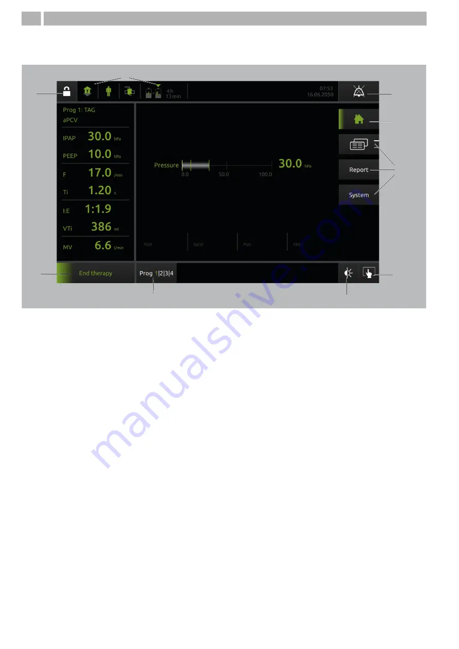 Lowenstein Medical LM150TD Instructions For Use Manual Download Page 8