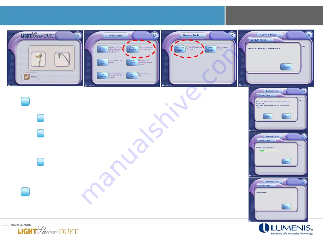 LUMENIS LightSheer Duet In-Servicing Training Download Page 13