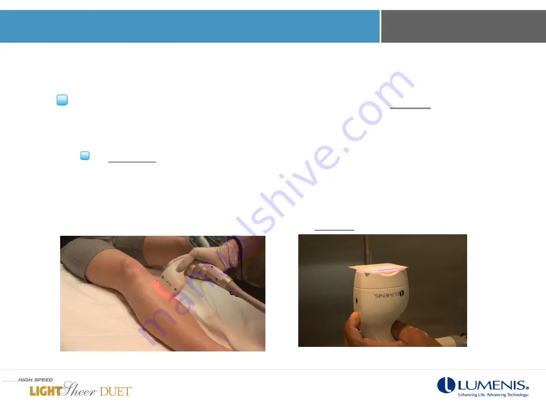 LUMENIS LightSheer Duet In-Servicing Training Download Page 59