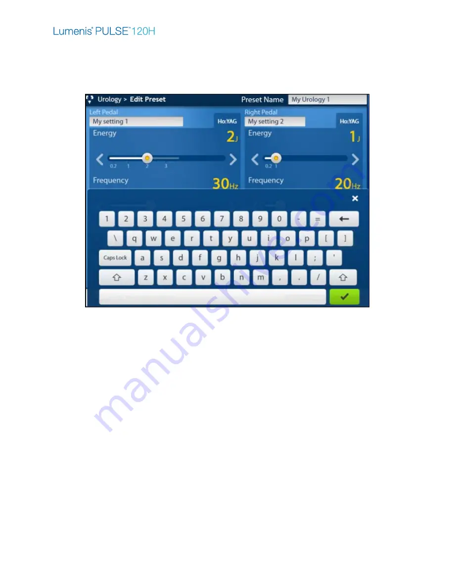 LUMENIS PULSE 120H Operator'S Manual Download Page 80