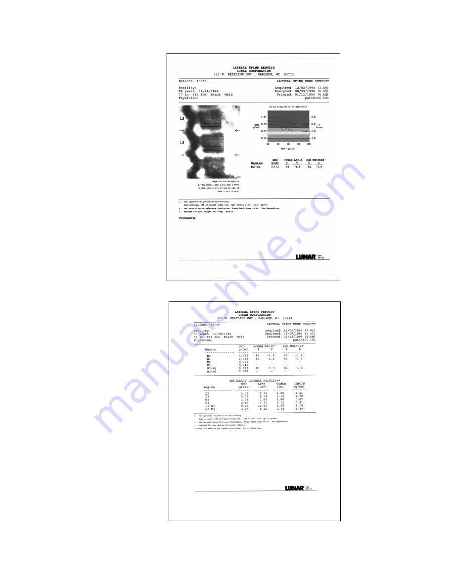 Lunar DPX-IQ Operator'S Manual Download Page 86