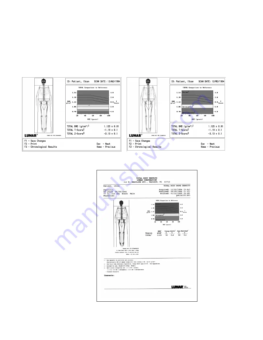 Lunar DPX-IQ Operator'S Manual Download Page 94