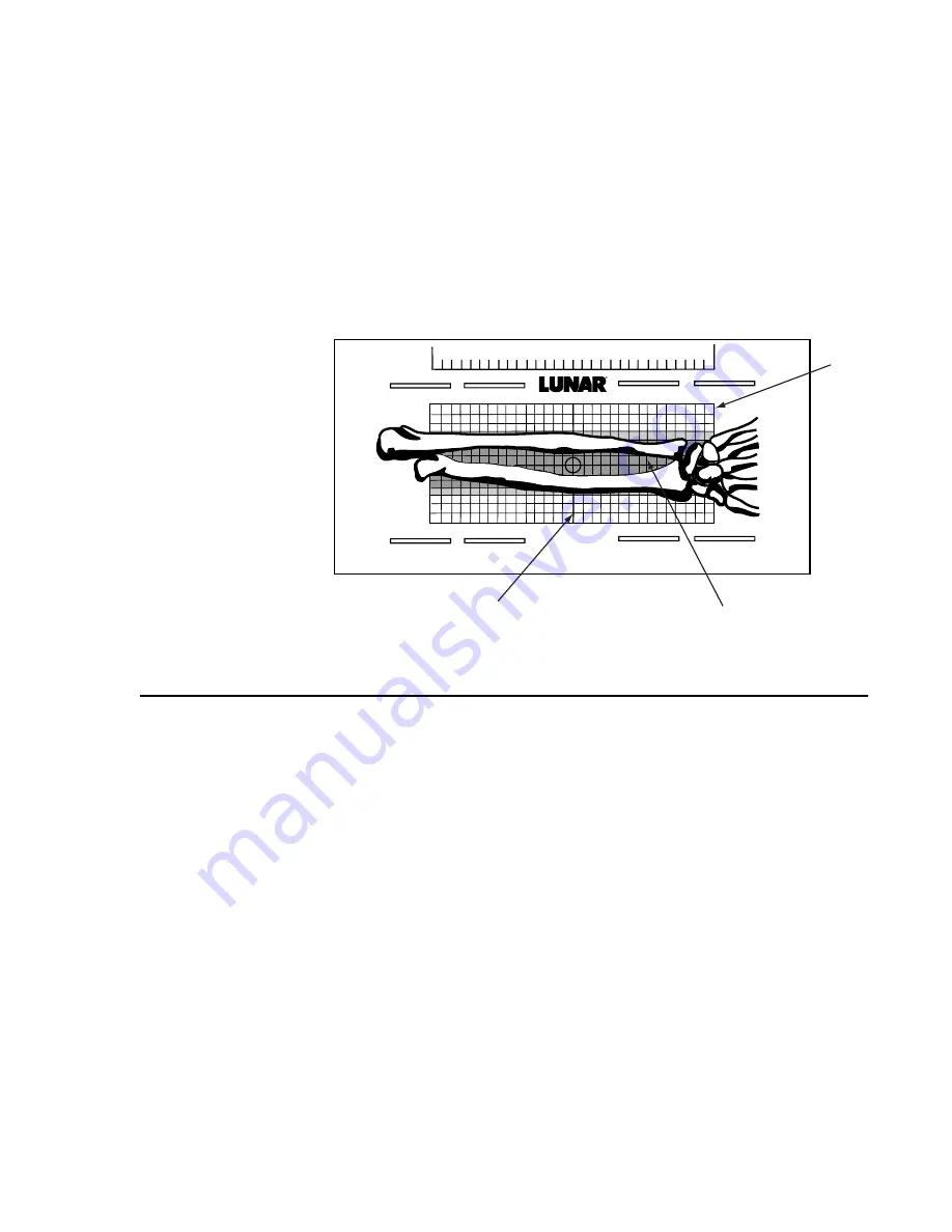 Lunar DPX-IQ Operator'S Manual Download Page 105