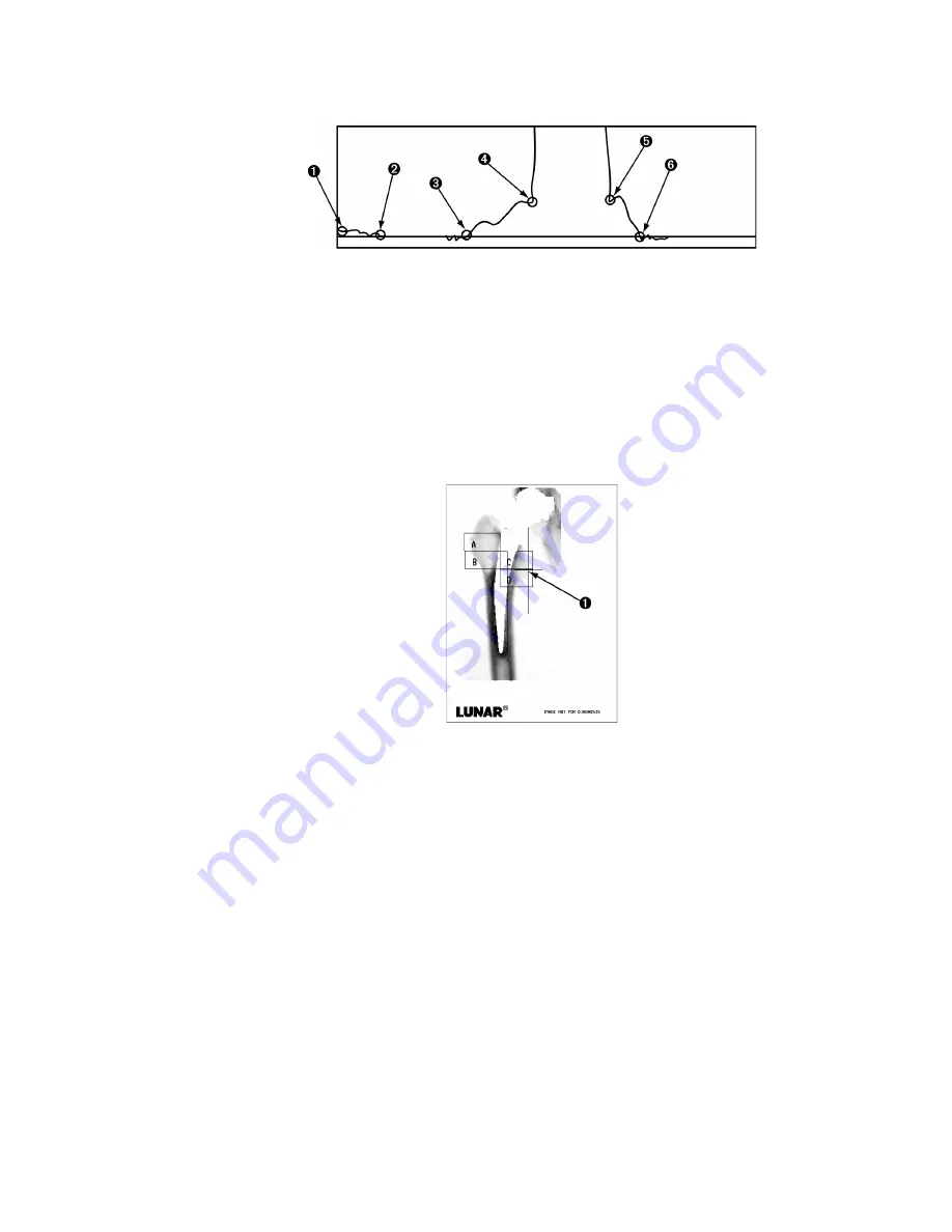 Lunar DPX-IQ Operator'S Manual Download Page 124