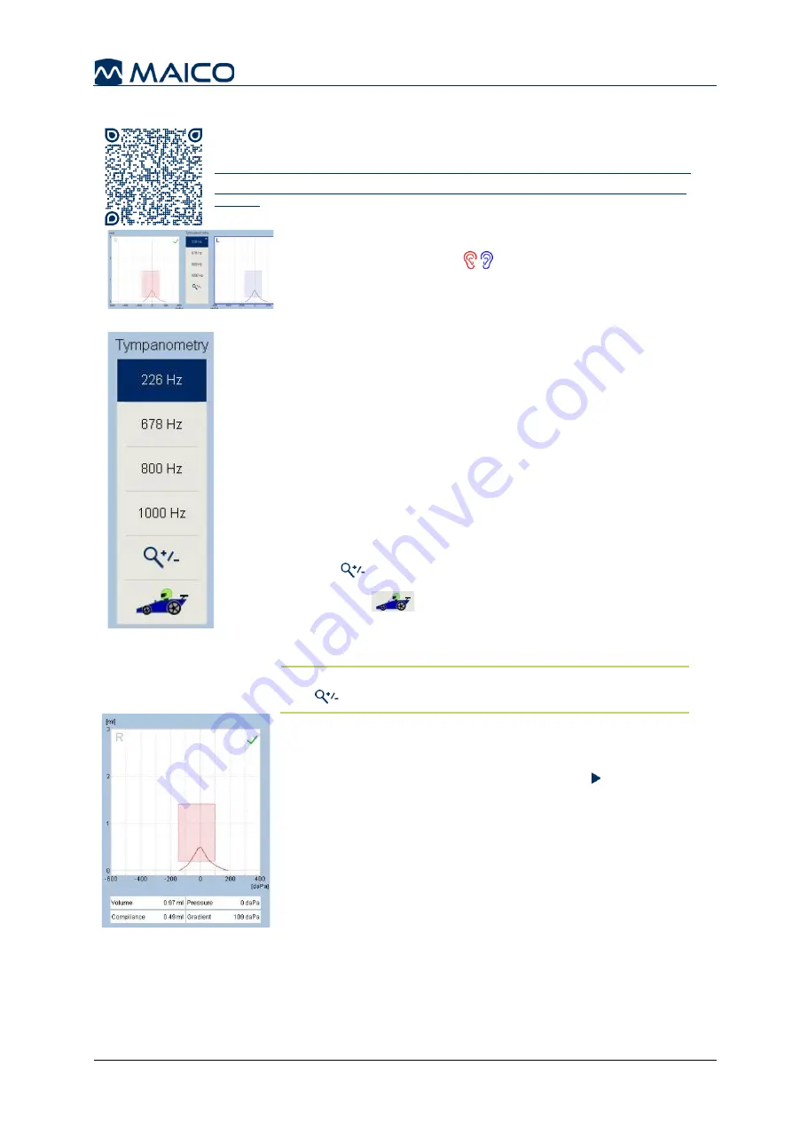 Maico touchTymp MI 26 Operation Manual Download Page 40