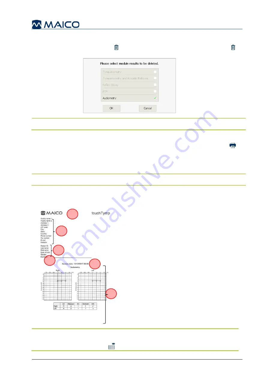 Maico touchTymp MI 26 Operation Manual Download Page 62