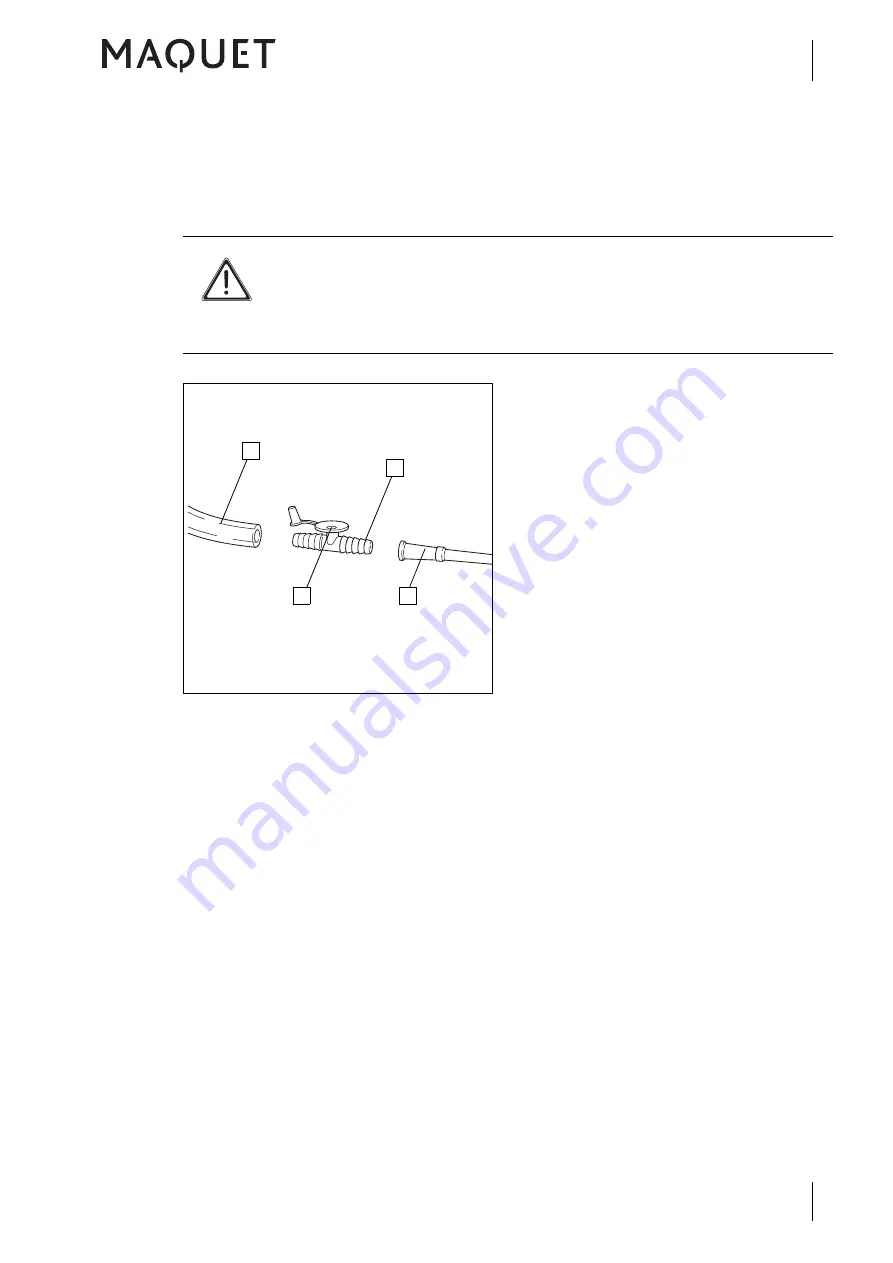 Maquet 5752 2345 Operating Instructions Manual Download Page 43