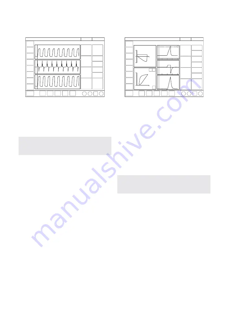 Maquet SERVO-air Скачать руководство пользователя страница 49