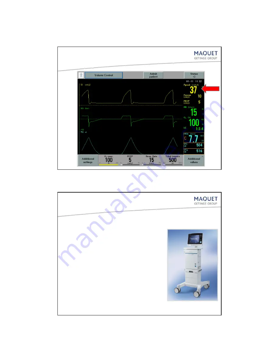 Maquet SERVO-i User Manual Download Page 9