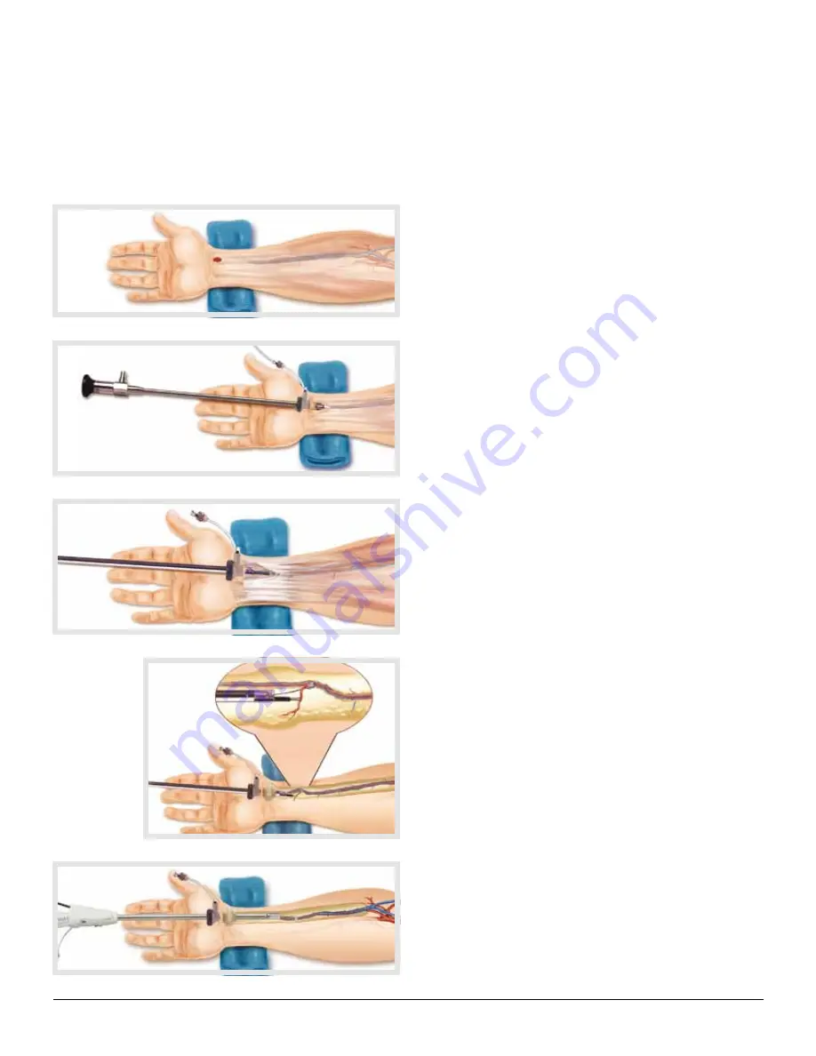 Maquet VASOVIEW 7 Training Manual Download Page 5