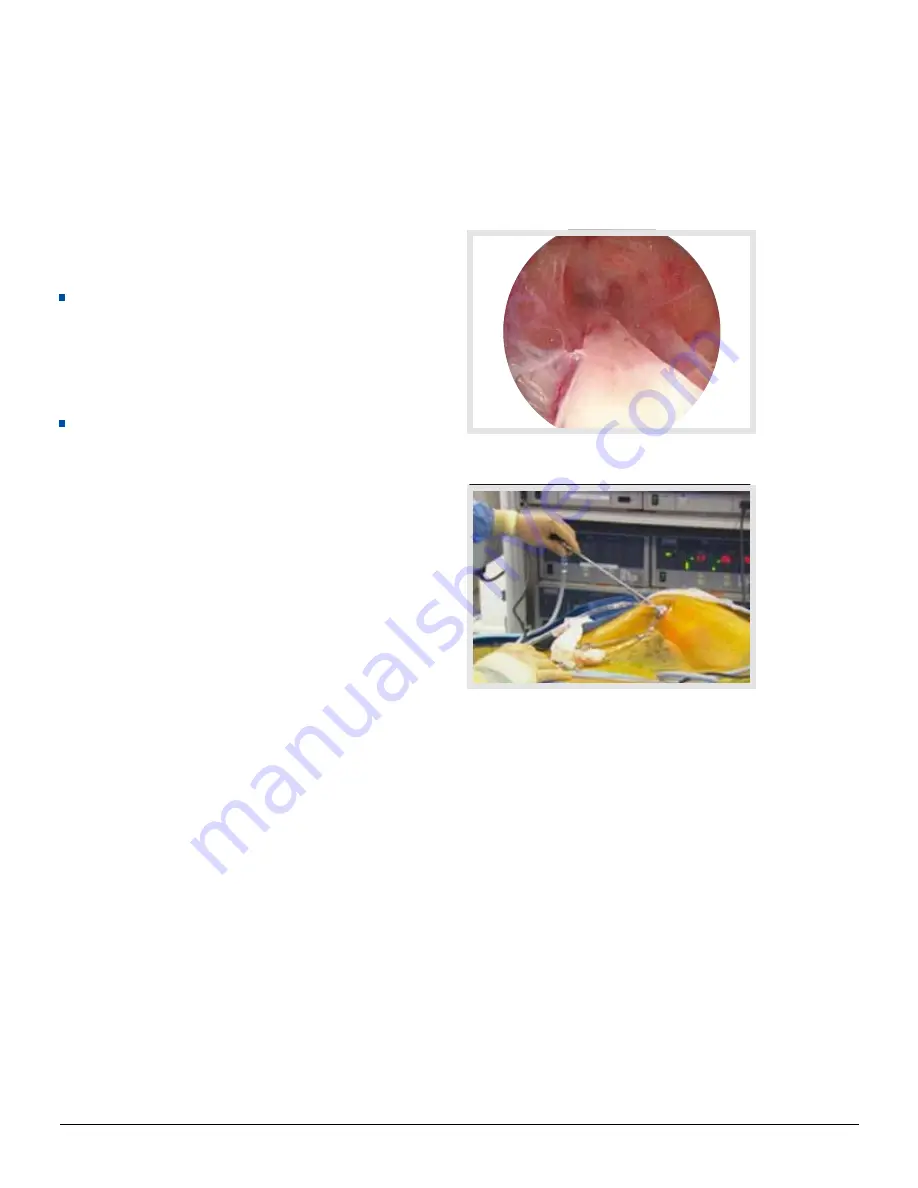 Maquet VASOVIEW 7 Training Manual Download Page 11