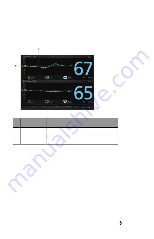 Masimo O3 Regional Oximeter Скачать руководство пользователя страница 28