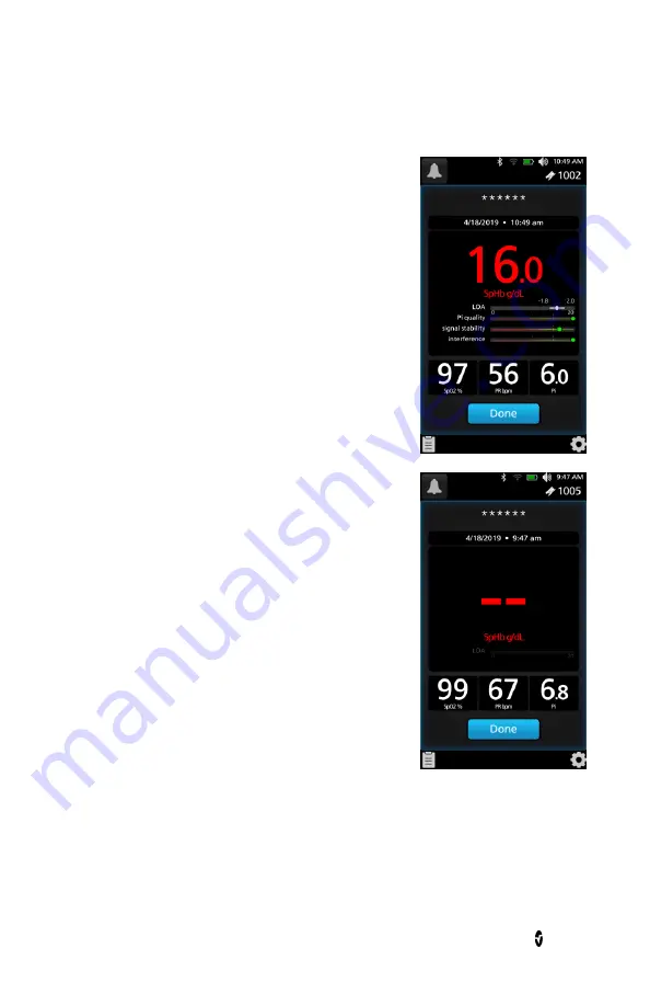 Masimo Rad-67 Pulse CO-Oximeter Operator'S Manual Download Page 63