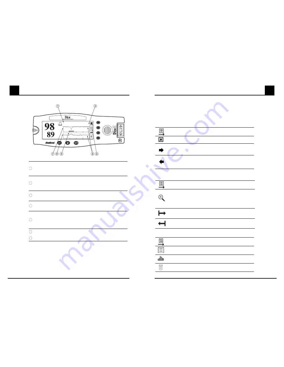 Masimo Radical Signal Extraction Operator'S Manual Download Page 29