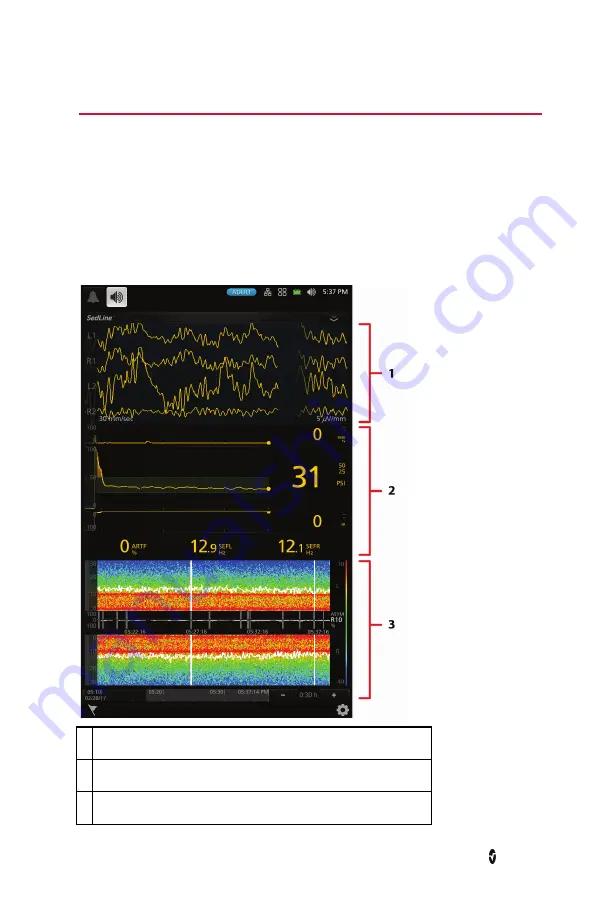 Masimo sedline Operator'S Manual Download Page 25