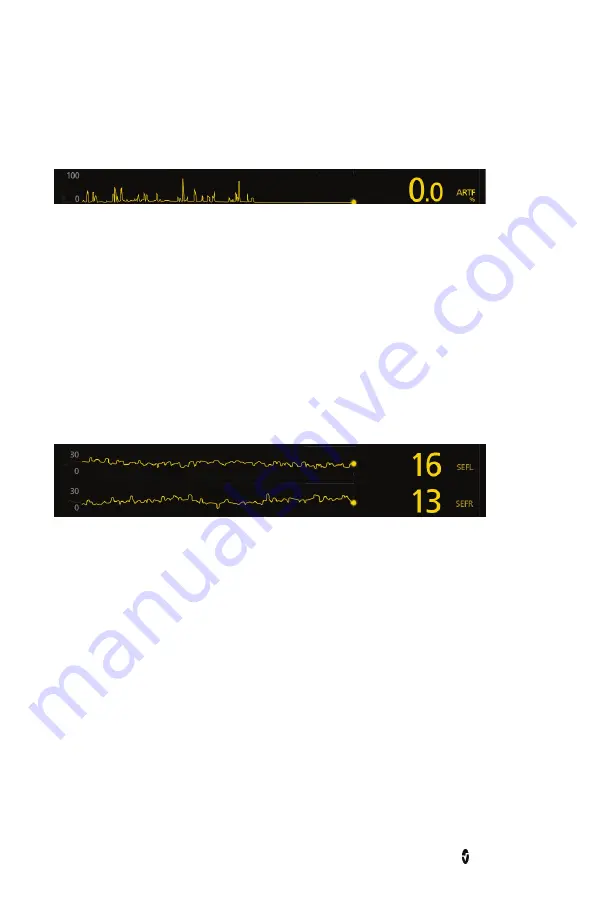 Masimo sedline Operator'S Manual Download Page 32