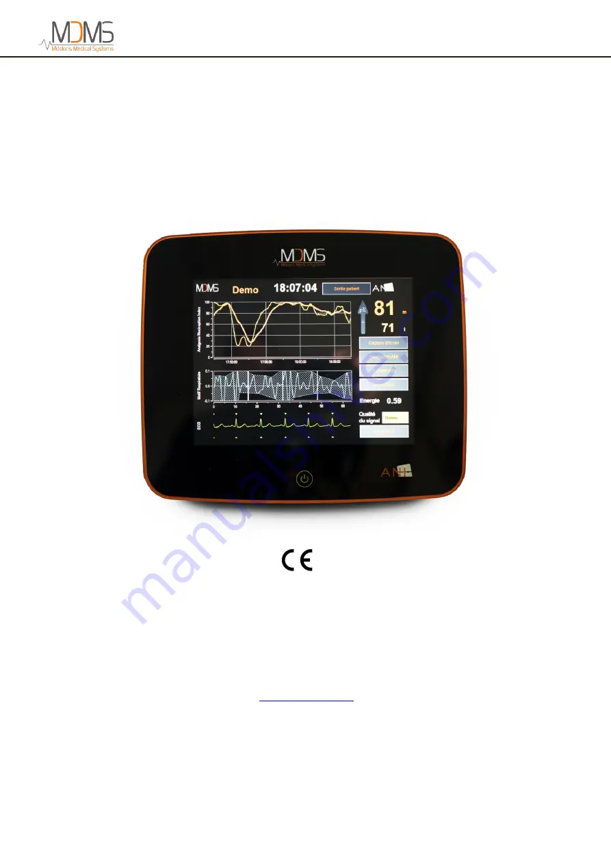 MDMS ANI Monitor V2 User Manual Download Page 1