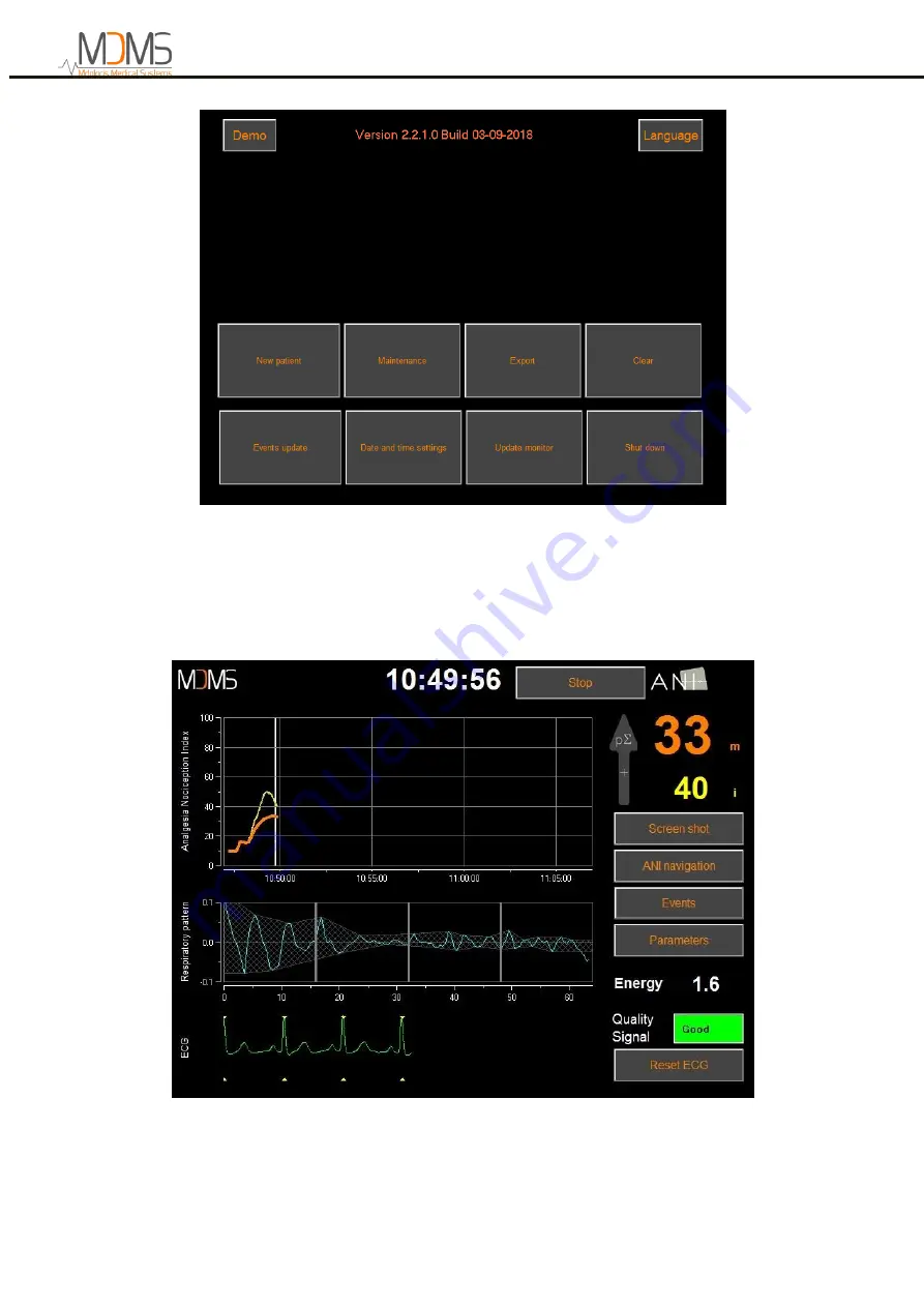 MDMS ANI Monitor V2 Скачать руководство пользователя страница 16